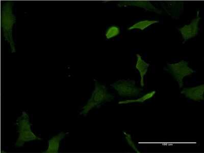 Immunocytochemistry/ Immunofluorescence: HHEX Antibody (2C8) [H00003087-M12]