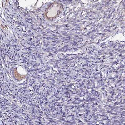 Immunohistochemistry-Paraffin: HHMJG Antibody [NBP1-91986]