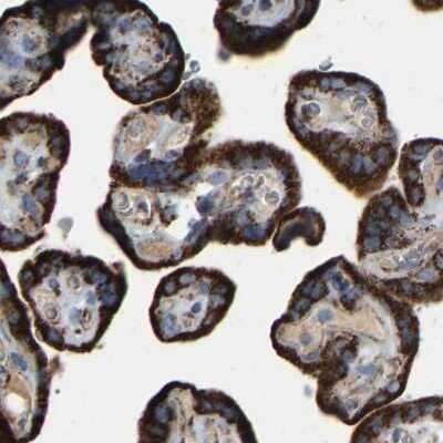Immunohistochemistry-Paraffin: HIBADH Antibody [NBP1-80985]
