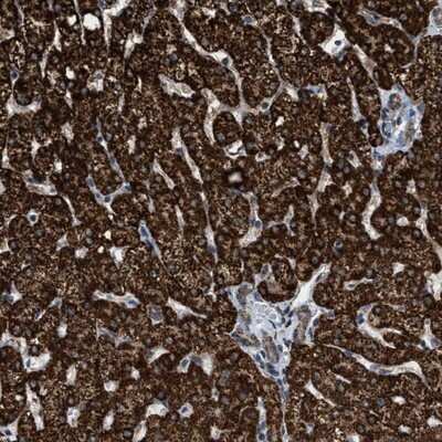 Immunohistochemistry-Paraffin: HIBADH Antibody [NBP1-82526]