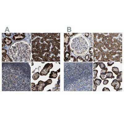 Immunohistochemistry-Paraffin: HIBADH Antibody [NBP1-82526]