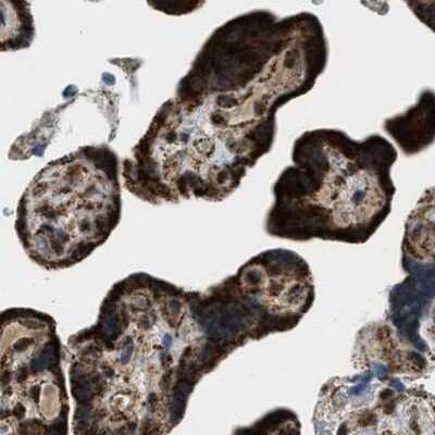 Immunohistochemistry-Paraffin: HIBADH Antibody [NBP1-82526]