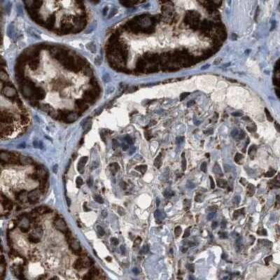Immunohistochemistry-Paraffin: HIBADH Antibody [NBP1-82526]