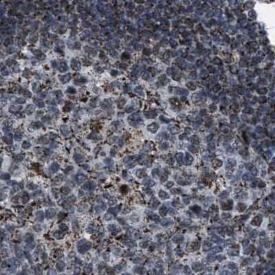 Immunohistochemistry-Paraffin: HIBADH Antibody [NBP1-82526]