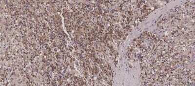 Immunohistochemistry: HIBCH Antibody (OTI3H5) [NBP2-02673]