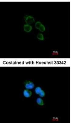 Immunocytochemistry/ Immunofluorescence: HIBCH Antibody [NBP1-32964]