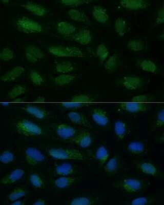 Immunocytochemistry/ Immunofluorescence: HIBCH Antibody - Azide and BSA Free [NBP3-15496]