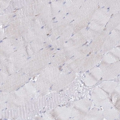 Immunohistochemistry-Paraffin: HIBCH Antibody [NBP2-32669]