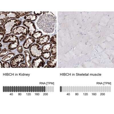Immunohistochemistry-Paraffin: HIBCH Antibody [NBP2-32669]