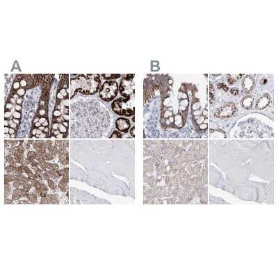 Immunohistochemistry-Paraffin: HIBCH Antibody [NBP2-32669]