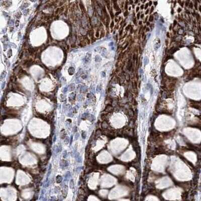 Immunohistochemistry-Paraffin: HIBCH Antibody [NBP2-32669]