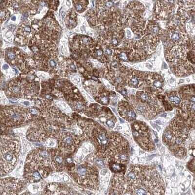 Immunohistochemistry-Paraffin: HIBCH Antibody [NBP2-32669]