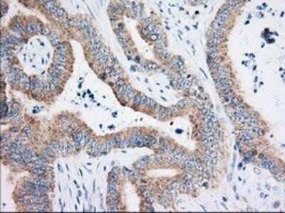 Immunohistochemistry: HIBCH Antibody (OTI3H5) - Azide and BSA Free [NBP2-71796]