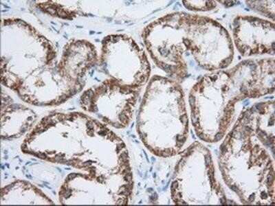 Immunohistochemistry: HIBCH Antibody (OTI3H5) - Azide and BSA Free [NBP2-71796]