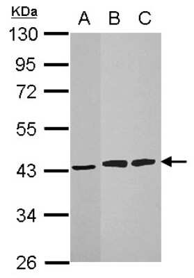 Western Blot: HIBCH Antibody [NBP1-32964]