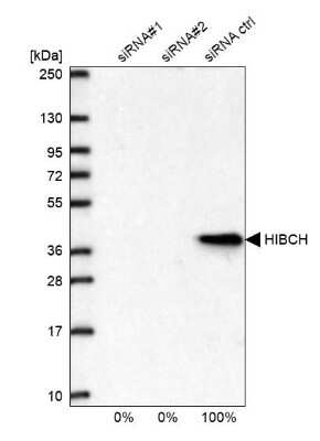 Western Blot: HIBCH Antibody [NBP2-32669]