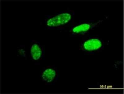 Immunocytochemistry/ Immunofluorescence: HIC1 Antibody (2F9) [H00003090-M02]