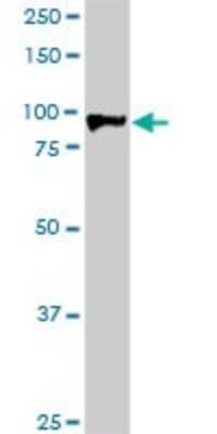 Western Blot: HIC1 Antibody (2F9) [H00003090-M02]
