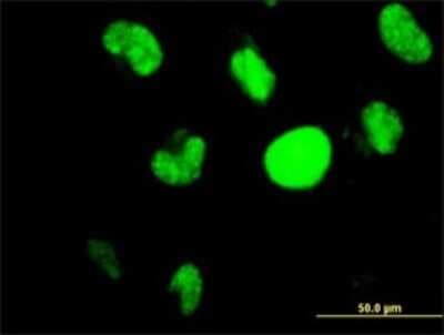 Immunocytochemistry/ Immunofluorescence: HIC1 Antibody (4E11) [H00003090-M01]