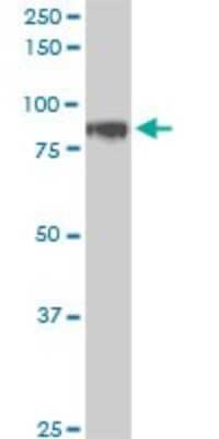 Western Blot: HIC1 Antibody (4E11) [H00003090-M01]