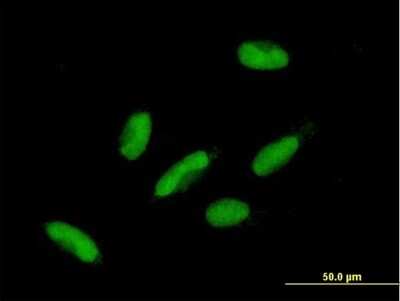Immunocytochemistry/ Immunofluorescence: HIC2 Antibody [H00023119-B01P]