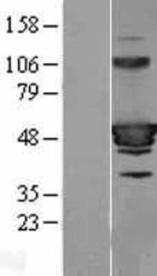 Western Blot: HIC5/TGFB1I1 Overexpression Lysate [NBL1-16853]