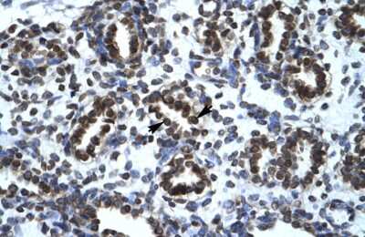 Immunohistochemistry: HIC5/TGFB1I1 Antibody [NBP3-10300]