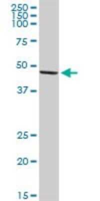 Western Blot: HIC5/TGFB1I1 Antibody [H00007041-D01P]