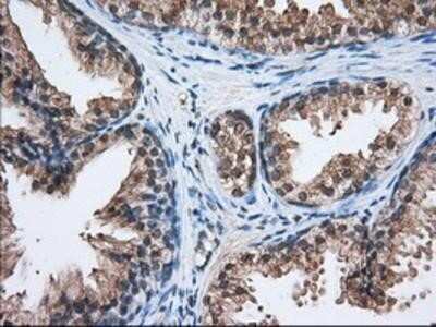 Immunohistochemistry: HID1 Antibody (OTI2F4) - Azide and BSA Free [NBP2-72481]