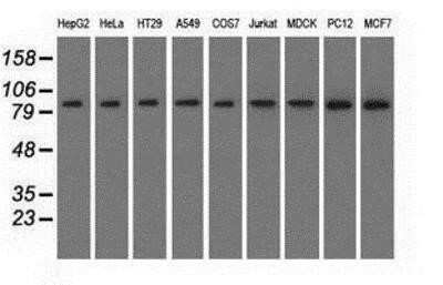 Western Blot: HID1 Antibody (OTI2F4)Azide and BSA Free [NBP2-72481]