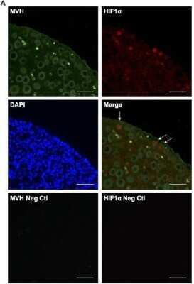 Immunocytochemistry/ Immunofluorescence: HIF-1 alpha Antibody - BSA Free [NB100-134]