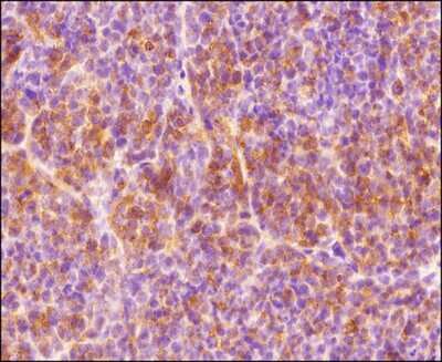Immunohistochemistry-Paraffin: HIF-1 alpha Antibody - BSA Free [NB100-134]