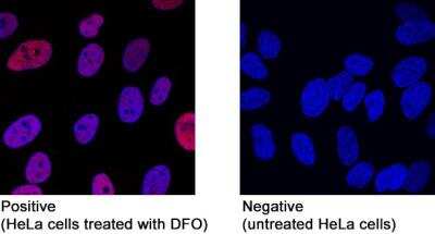 Immunocytochemistry/ Immunofluorescence: HIF-1 alpha Antibody (2443B) - BSA Free [NBP2-75977]