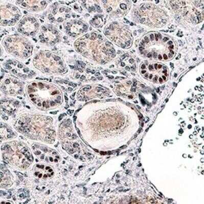 Immunohistochemistry: HIF-1 alpha Antibody (2443C) - Azide and BSA Free [NBP2-80765]
