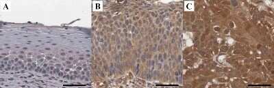 Immunohistochemistry: HIF-1 alpha Antibody (ESEE122) - Azide and BSA Free [NBP2-80762]