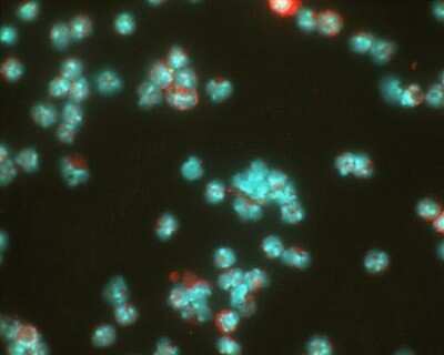 Immunocytochemistry/ Immunofluorescence: HIF-1 alpha Antibody (ESEE122) [NB100-131]