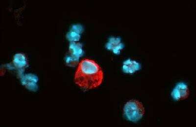 Immunocytochemistry/ Immunofluorescence: HIF-1 alpha Antibody (ESEE122) [NB100-131]