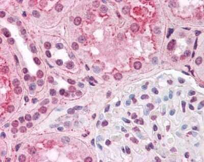 Immunohistochemical Staining of HIF-1 alpha in Human Kidney