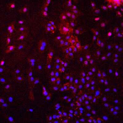 Immunocytochemistry/ Immunofluorescence: HIF-1 alpha Antibody (H1alpha67) [NB100-123]