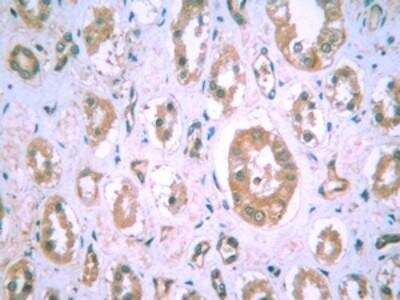 Immunohistochemistry: HIF-1 alpha Antibody (H1alpha67) [NB100-123]