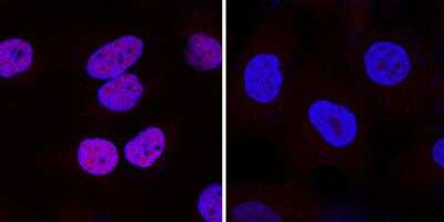 Knockout Validation of HIF-1 alpha Antibody in HeLa and HIF-1 Knockout HeLa Cells