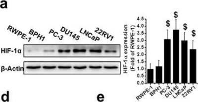 Western Blot Detection of HIF-1 alpha in Nonmalignant and PCa Cell Lines