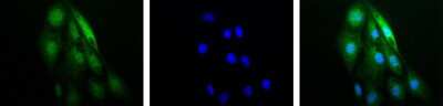 Immunocytochemistry/Immunofluorescence Staining of HIF-1 alpha in RCC4 Cells