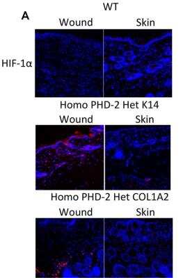 Immunohistological Analysis of HIF-1 alpha in Wounded and non-Wounded Mouse Tissues