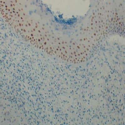 Immunohistological Staining of HIF-1 alpha in Paraffin Embedded Mouse Skin Wound