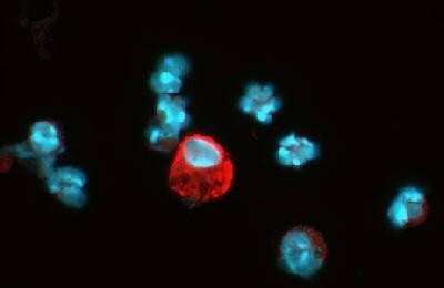 Immunocytochemistry/ Immunofluorescence: HIF-1 alpha Antibody Pack [NB100-905]
