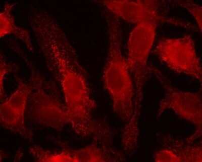 Immunocytochemistry/ Immunofluorescence: HIF-1 alpha Antibody Pack [NB100-905]