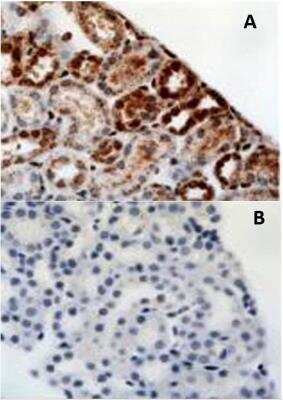 Immunohistochemistry: HIF-1 alpha Antibody Pack [NB100-905]