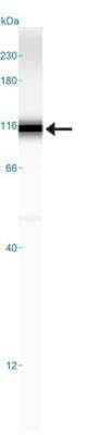 Simple Western: HIF-1 alpha Antibody Pack [NB100-900WB]