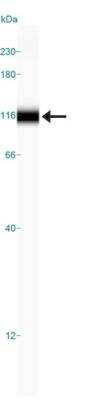 Simple Western: HIF-1 alpha Antibody Pack [NB100-905]